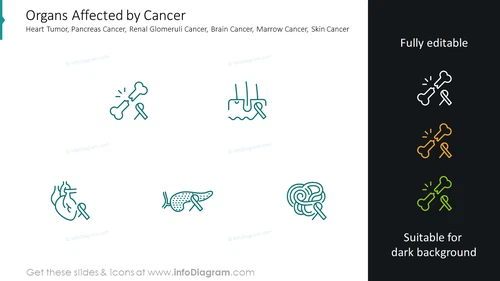 Organs affected by cancer slide: heart tumor, pancreas cancer