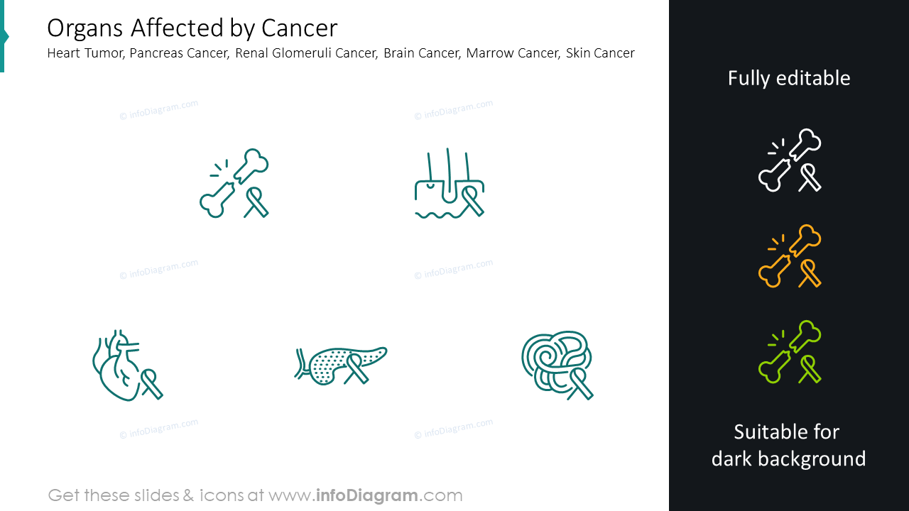 Organs affected by cancer slide: heart tumor, pancreas cancer